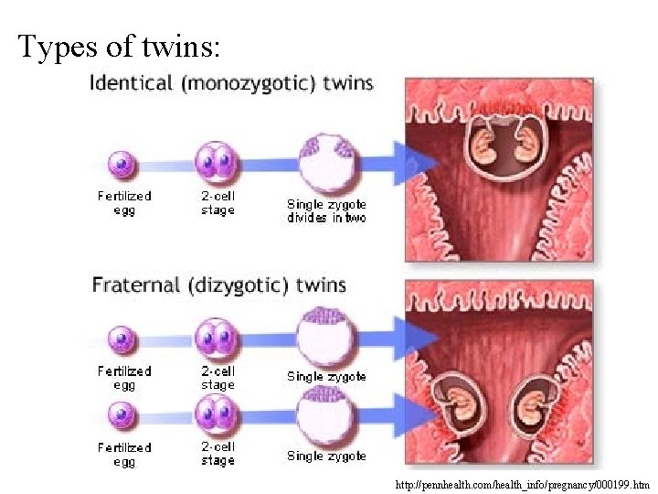 Types of twins: http: //pennhealth. com/health_info/pregnancy/000199. htm 