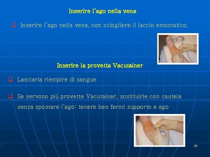 Inserire l’ago nella vena q Inserire l’ago nella vena, non sciogliere il laccio emostatico.