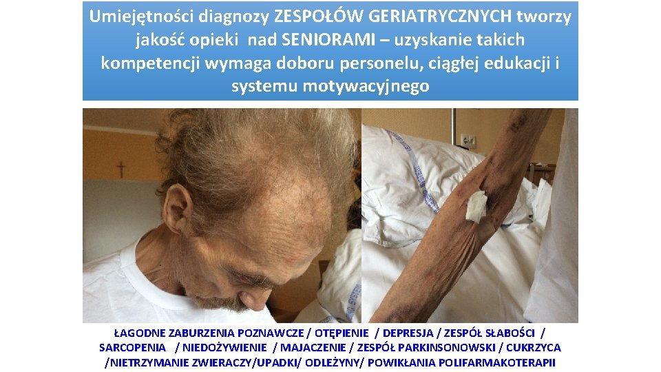 Umiejętności diagnozy ZESPOŁÓW GERIATRYCZNYCH tworzy jakość opieki nad SENIORAMI – uzyskanie takich kompetencji wymaga