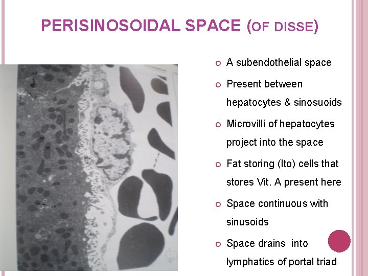 PERISINOSOIDAL SPACE (OF DISSE) A subendothelial space Present between hepatocytes & sinosuoids Microvilli of