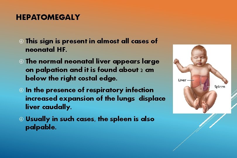 HEPATOMEGALY This sign is present in almost all cases of neonatal HF. The normal