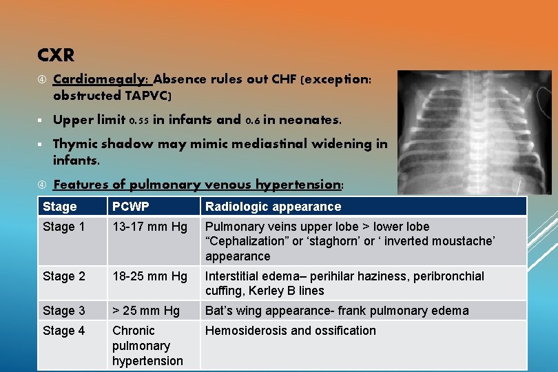 CXR Cardiomegaly: Absence rules out CHF (exception: obstructed TAPVC) § Upper limit 0. 55