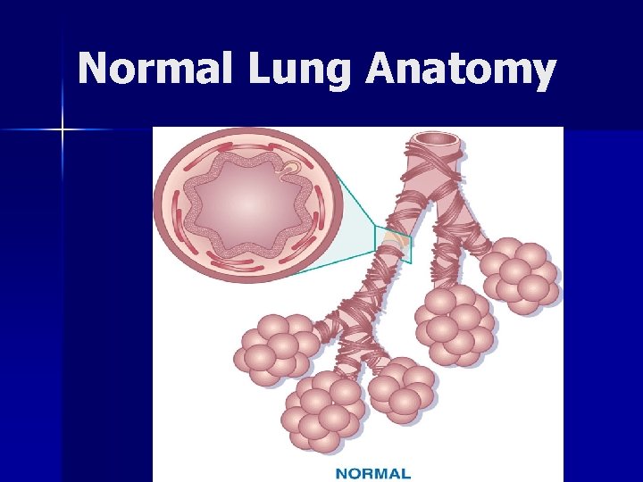 Normal Lung Anatomy 