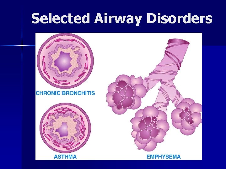 Selected Airway Disorders 