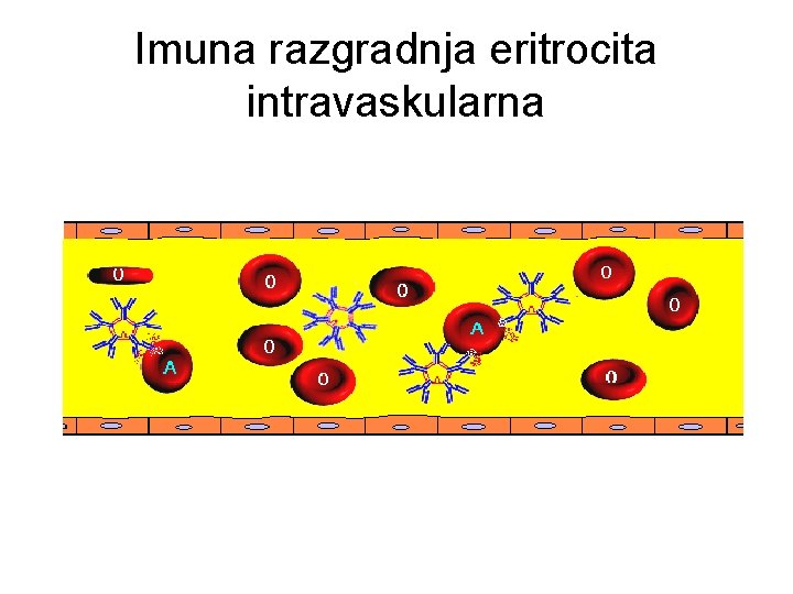 Imuna razgradnja eritrocita intravaskularna 
