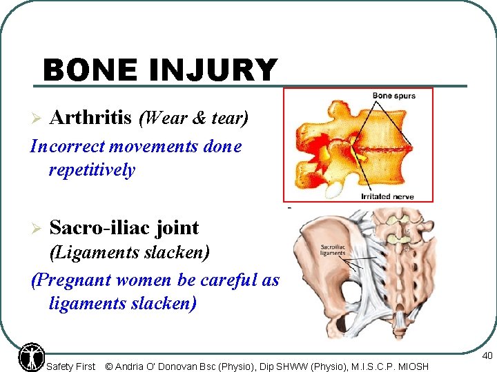 BONE INJURY Ø Arthritis (Wear & tear) Incorrect movements done repetitively Ø Sacro-iliac joint