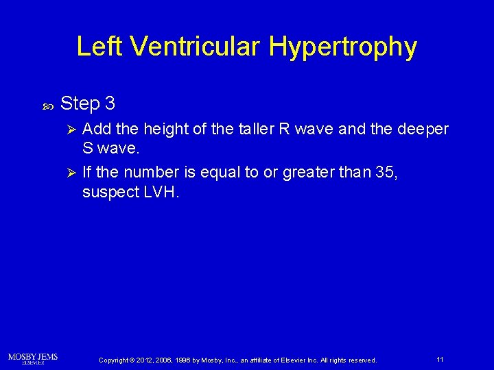 Left Ventricular Hypertrophy Step 3 Add the height of the taller R wave and