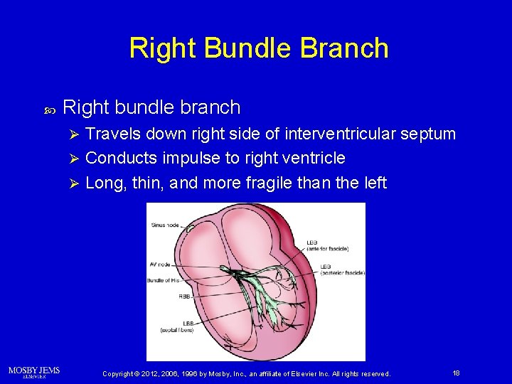 Right Bundle Branch Right bundle branch Travels down right side of interventricular septum Ø