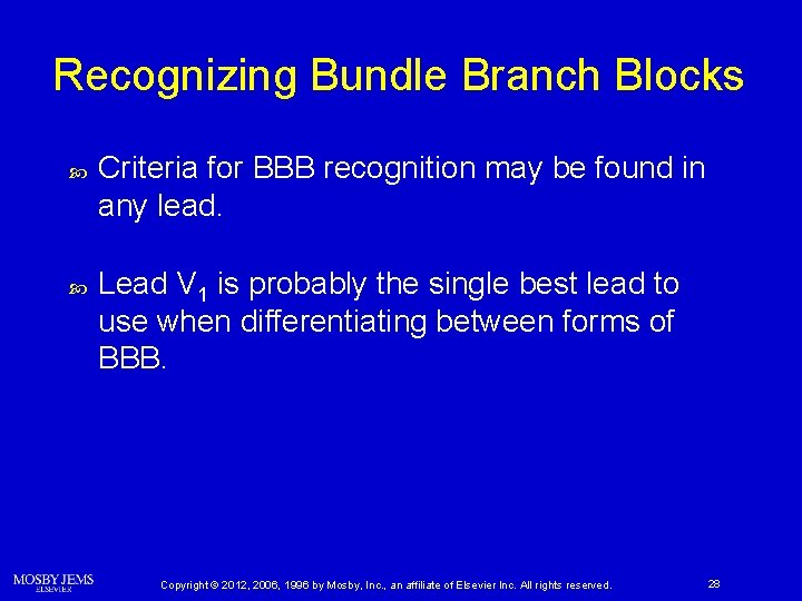 Recognizing Bundle Branch Blocks Criteria for BBB recognition may be found in any lead.