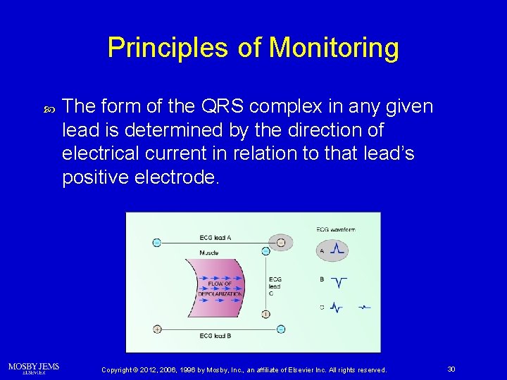 Principles of Monitoring The form of the QRS complex in any given lead is