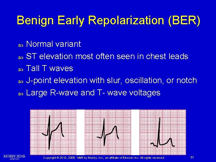 Benign Early Repolarization (BER) Normal variant ST elevation most often seen in chest leads