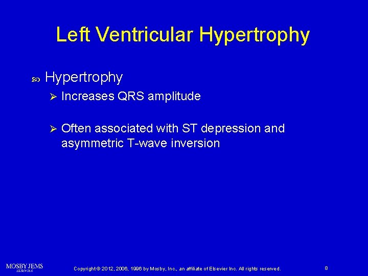 Left Ventricular Hypertrophy Ø Increases QRS amplitude Ø Often associated with ST depression and