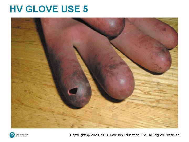 HV GLOVE USE 5 Copyright © 2020, 2016 Pearson Education, Inc. All Rights Reserved