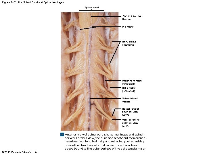 Figure 14. 2 c The Spinal Cord and Spinal Meninges Spinal cord Anterior median