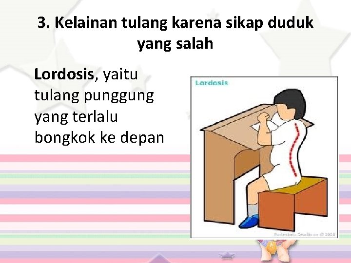3. Kelainan tulang karena sikap duduk yang salah Lordosis, yaitu tulang punggung yang terlalu
