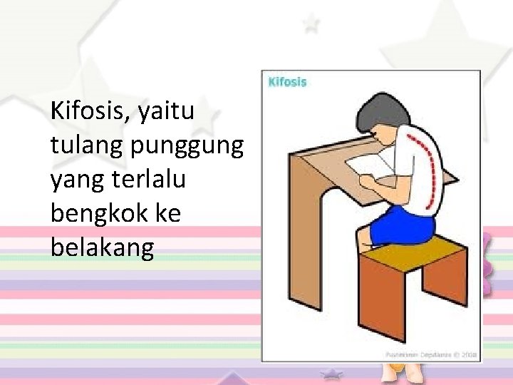 Kifosis, yaitu tulang punggung yang terlalu bengkok ke belakang 