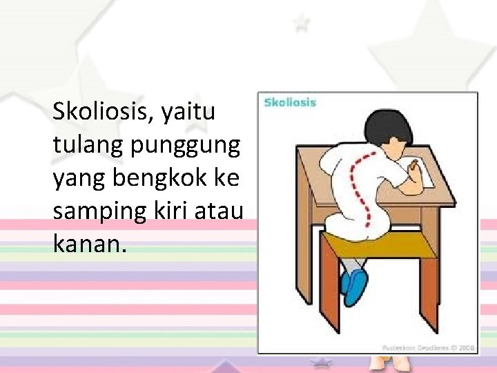 Skoliosis, yaitu tulang punggung yang bengkok ke samping kiri atau kanan. 