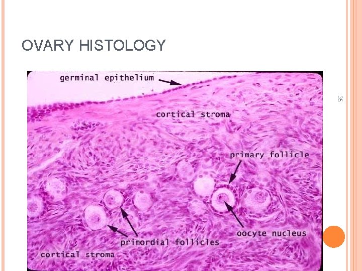 OVARY HISTOLOGY 35 