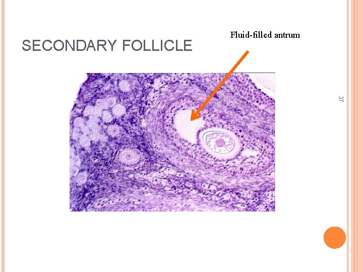 SECONDARY FOLLICLE Fluid-filled antrum 37 