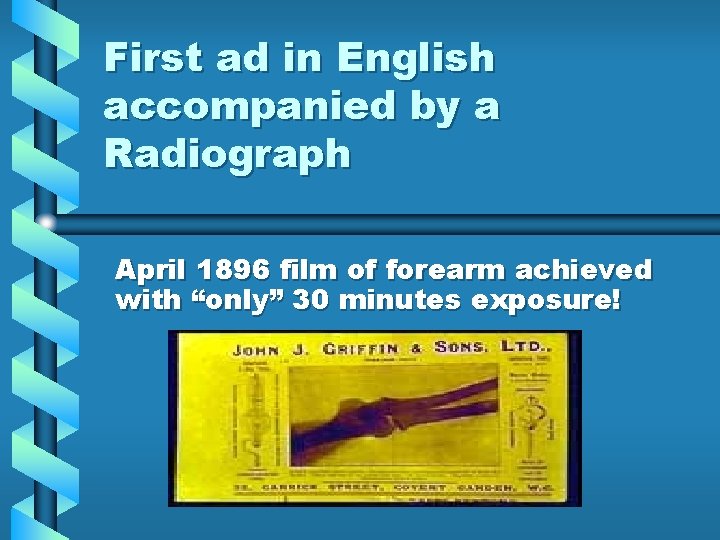 First ad in English accompanied by a Radiograph April 1896 film of forearm achieved First ad in English accompanied by a Radiograph April 1896 film of forearm achieved