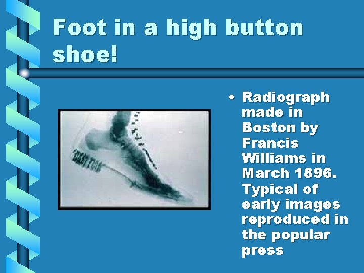 Foot in a high button shoe! • Radiograph made in Boston by Francis Williams Foot in a high button shoe! • Radiograph made in Boston by Francis Williams