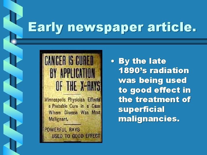 Early newspaper article. • By the late 1890’s radiation was being used to good Early newspaper article. • By the late 1890’s radiation was being used to good