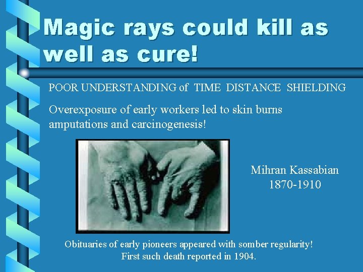 Magic rays could kill as well as cure! POOR UNDERSTANDING of TIME DISTANCE SHIELDING Magic rays could kill as well as cure! POOR UNDERSTANDING of TIME DISTANCE SHIELDING