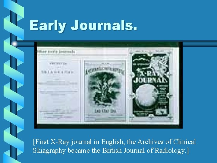 Early Journals. [First X-Ray journal in English, the Archives of Clinical Skiagraphy became the Early Journals. [First X-Ray journal in English, the Archives of Clinical Skiagraphy became the