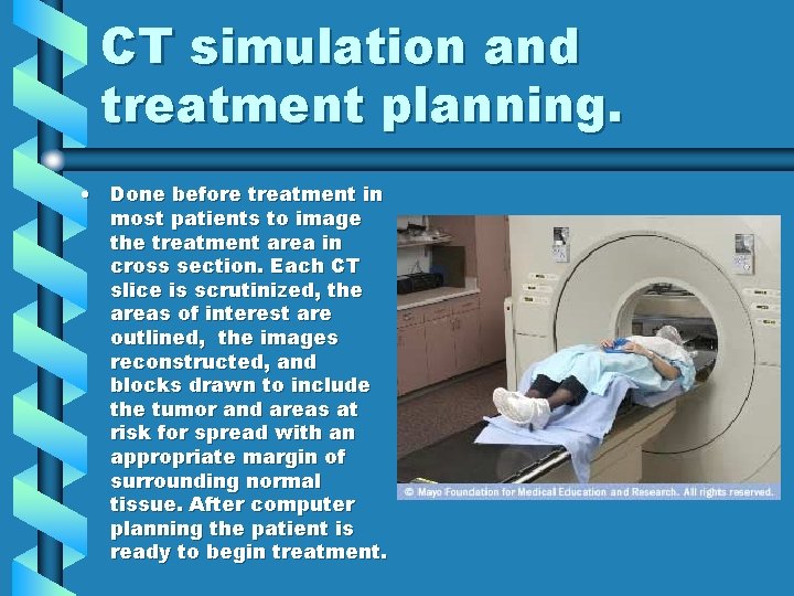 CT simulation and treatment planning. • Done before treatment in most patients to image CT simulation and treatment planning. • Done before treatment in most patients to image