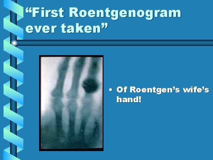 “First Roentgenogram ever taken” • Of Roentgen’s wife’s hand! “First Roentgenogram ever taken” • Of Roentgen’s wife’s hand!