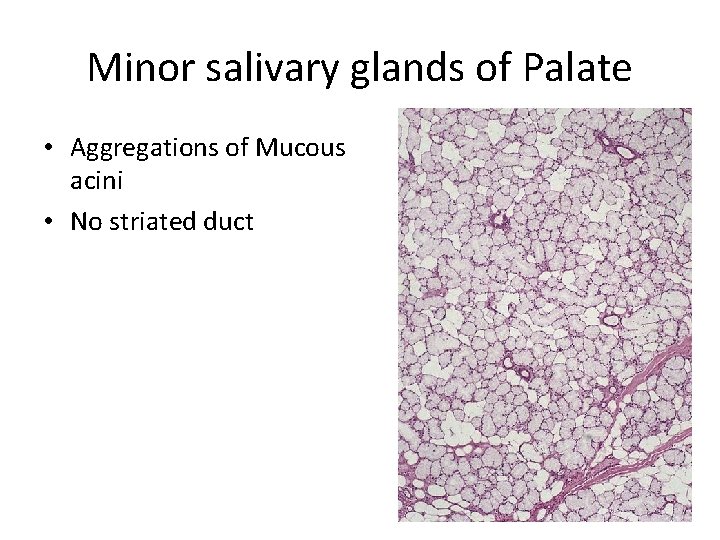 Minor salivary glands of Palate • Aggregations of Mucous acini • No striated duct