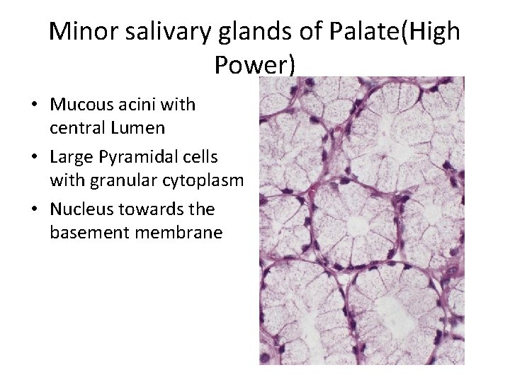 Minor salivary glands of Palate(High Power) • Mucous acini with central Lumen • Large
