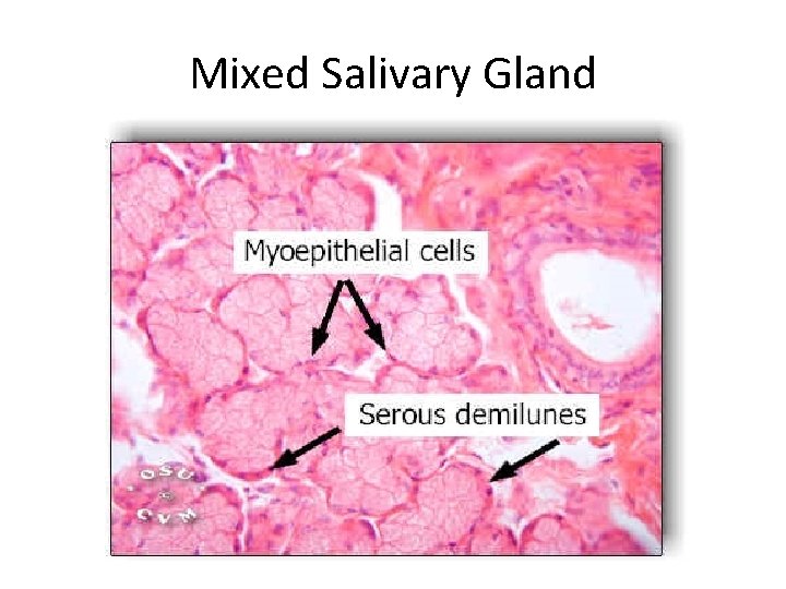 Mixed Salivary Gland 