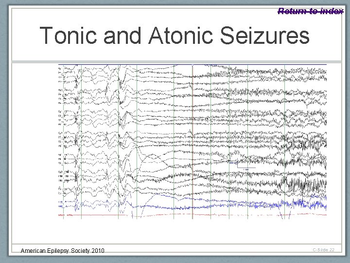Return to index Tonic and Atonic Seizures American Epilepsy Society 2010 C-Slide 22 