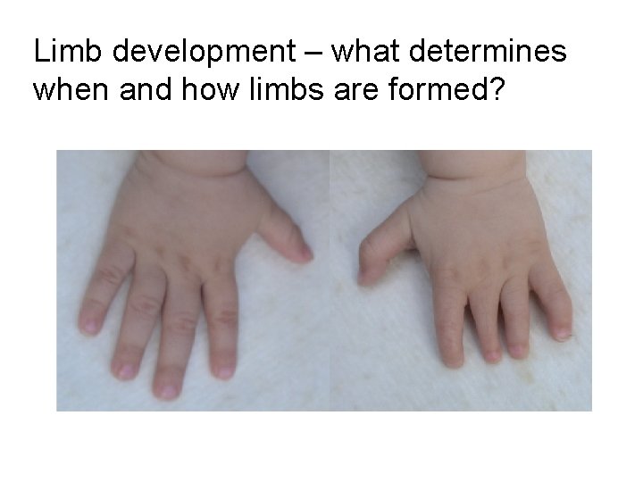 Limb development – what determines when and how limbs are formed? 
