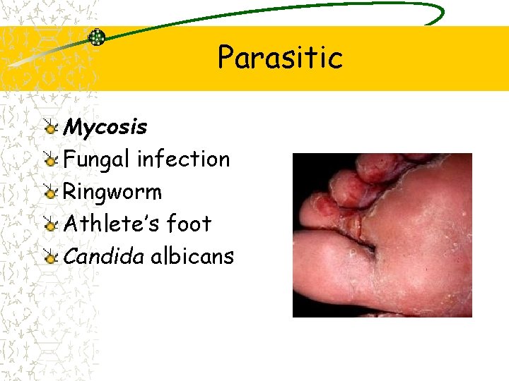 Parasitic Mycosis Fungal infection Ringworm Athlete’s foot Candida albicans 