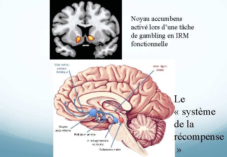 Noyau accumbens activé lors d’une tâche de gambling en IRM fonctionnelle Le « système