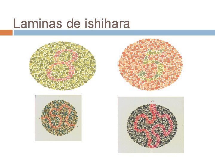 Laminas de ishihara Laminas de ishihara
