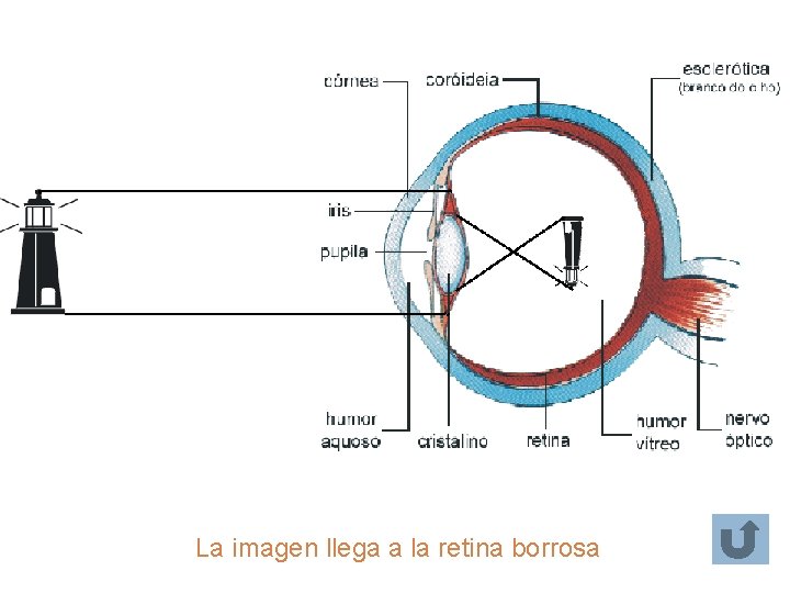 La imagen llega a la retina borrosa La imagen llega a la retina borrosa
