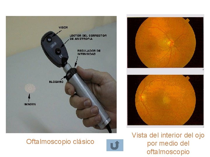 Oftalmoscopio clásico Vista del interior del ojo por medio del oftalmoscopio Oftalmoscopio clásico Vista del interior del ojo por medio del oftalmoscopio