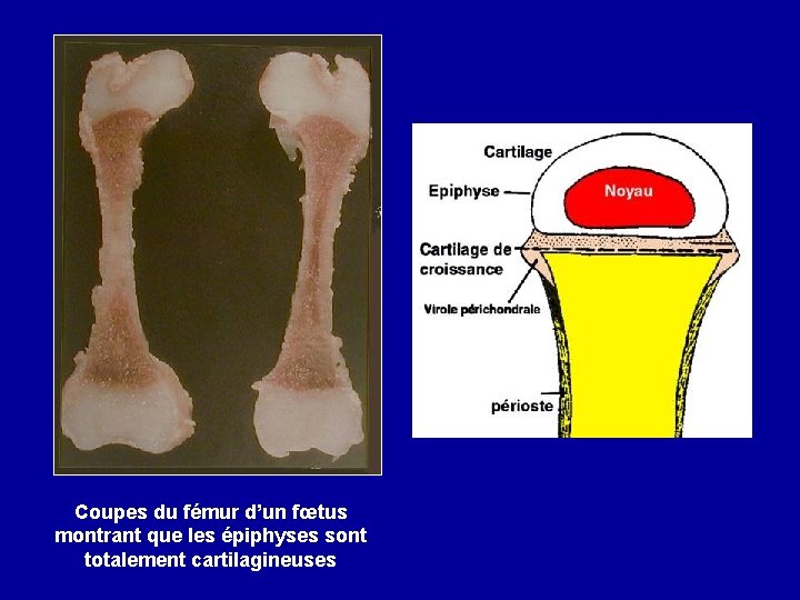 Coupes du fémur d’un fœtus montrant que les épiphyses sont totalement cartilagineuses 