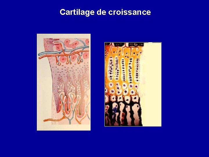 Cartilage de croissance 