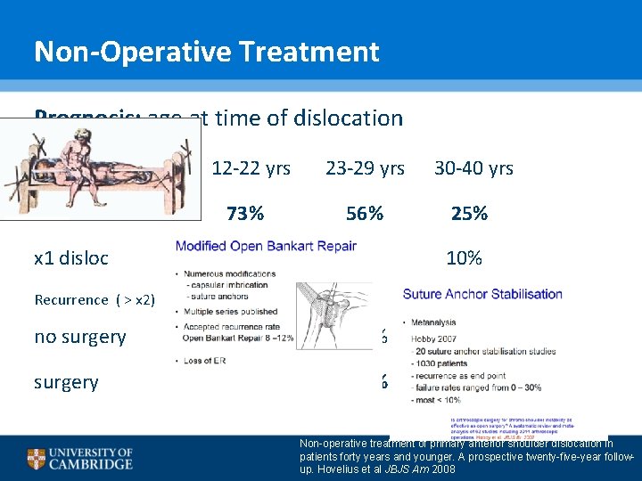 Non-Operative Treatment Prognosis: age at time of dislocation 12 -22 yrs 23 -29 yrs