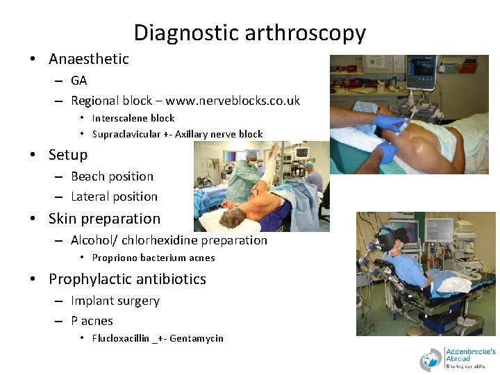 Diagnostic arthroscopy • Anaesthetic – GA – Regional block – www. nerveblocks. co. uk