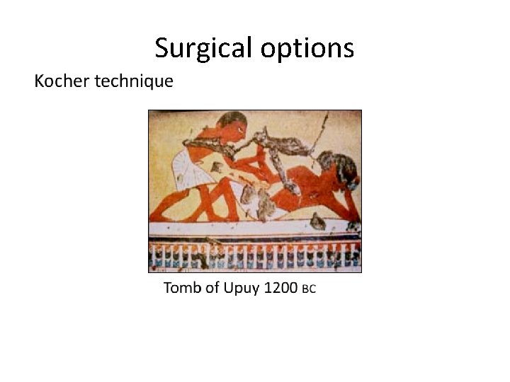 Surgical options 