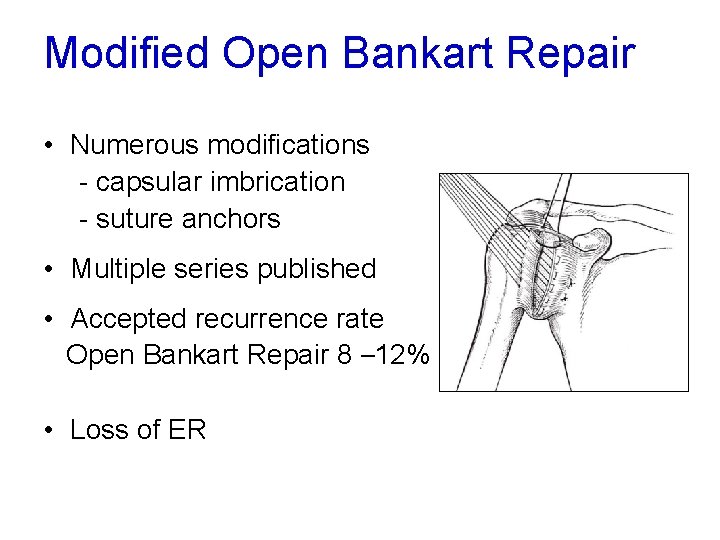 Modified Open Bankart Repair • Numerous modifications - capsular imbrication - suture anchors •