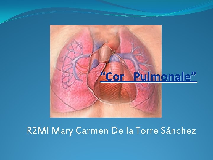“Cor Pulmonale” R 2 MI Mary Carmen De la Torre Sánchez “Cor Pulmonale” R 2 MI Mary Carmen De la Torre Sánchez