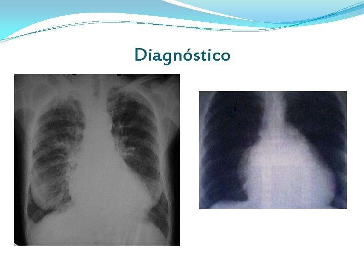 Diagnóstico Diagnóstico