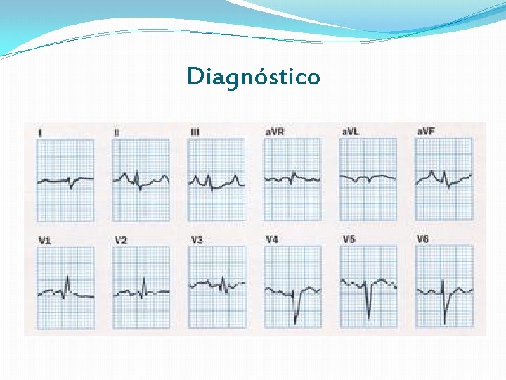 Diagnóstico Diagnóstico