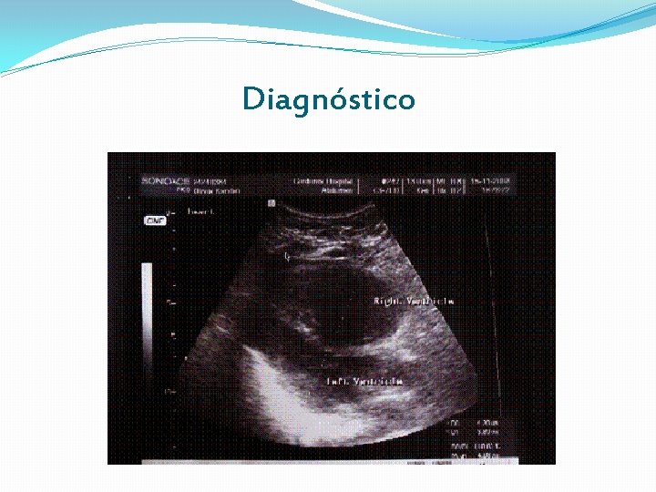 Diagnóstico Diagnóstico